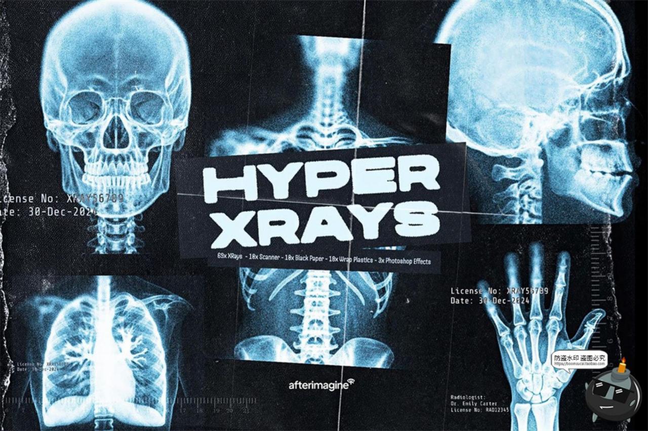图片[1]-医学骨骼X光扫描影像潮流未来科幻X射线脊椎背景高清JPG图片素材-设计猿