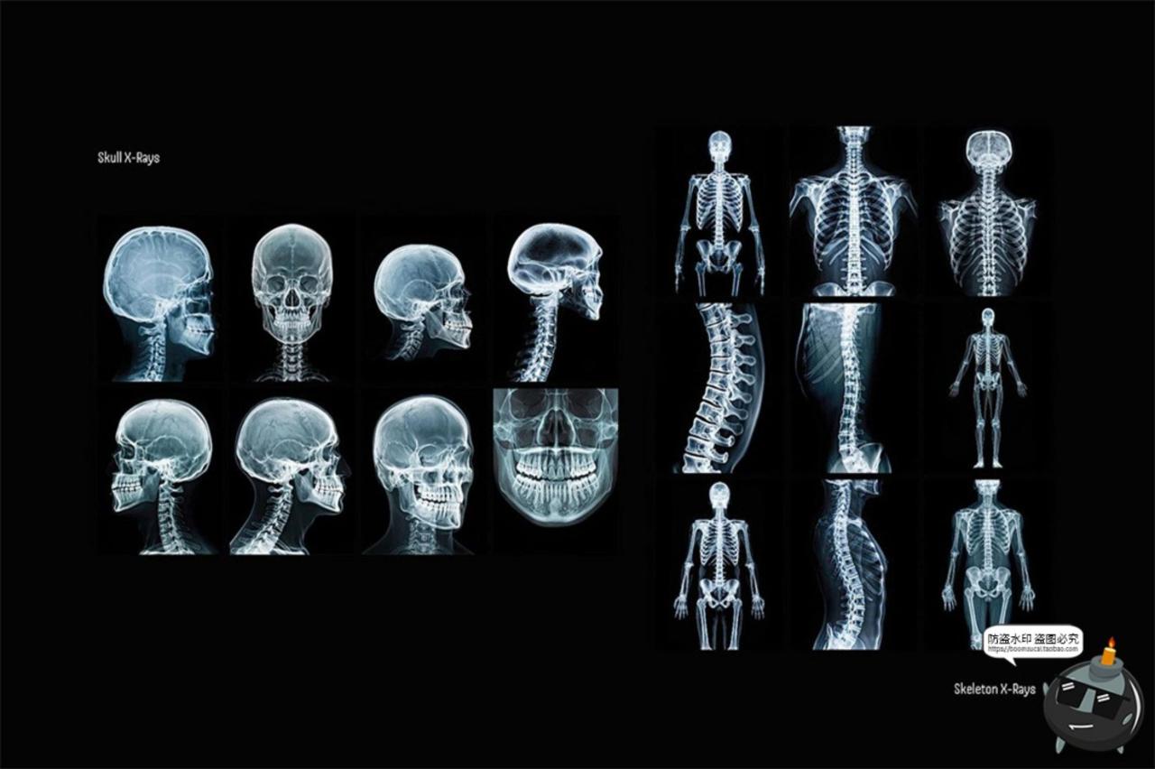 图片[2]-医学骨骼X光扫描影像潮流未来科幻X射线脊椎背景高清JPG图片素材-设计猿