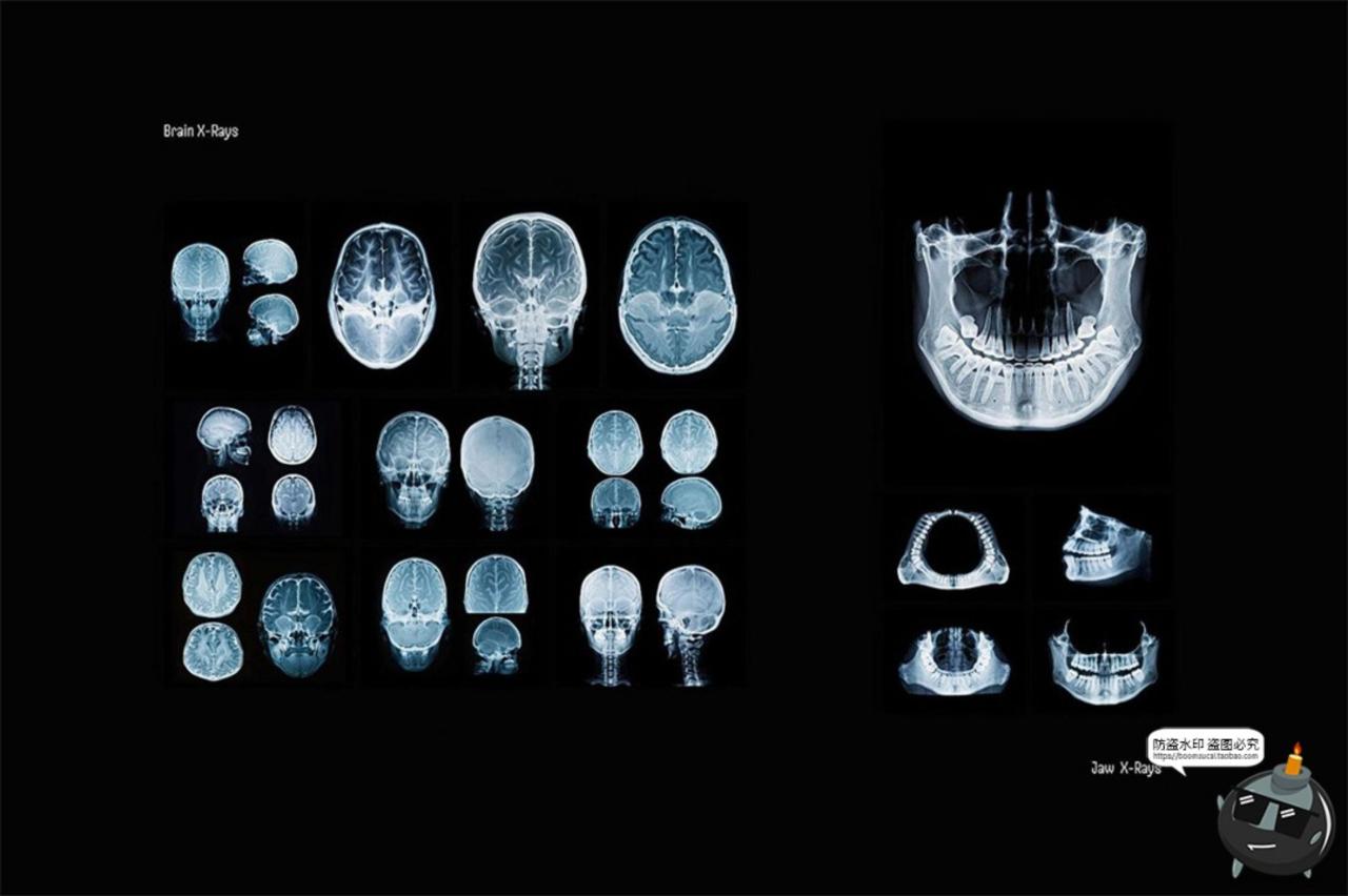 图片[3]-医学骨骼X光扫描影像潮流未来科幻X射线脊椎背景高清JPG图片素材-设计猿