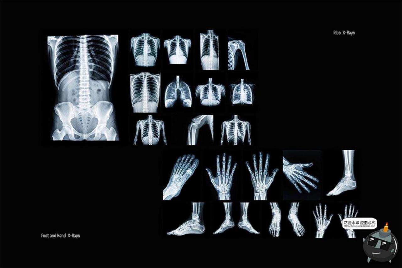 图片[4]-医学骨骼X光扫描影像潮流未来科幻X射线脊椎背景高清JPG图片素材-设计猿