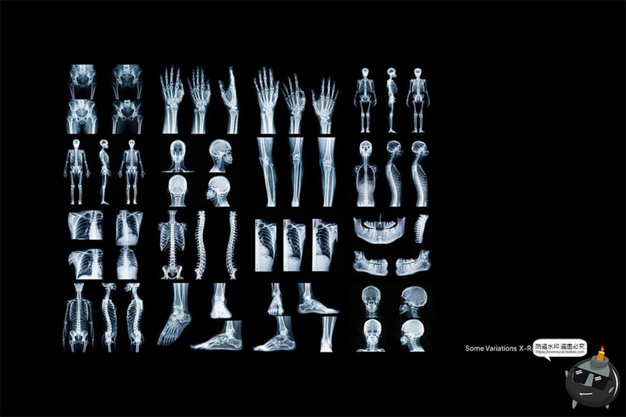图片[5]-医学骨骼X光扫描影像潮流未来科幻X射线脊椎背景高清JPG图片素材-设计猿